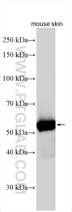 WB analysis of mouse skin using 26149-1-AP