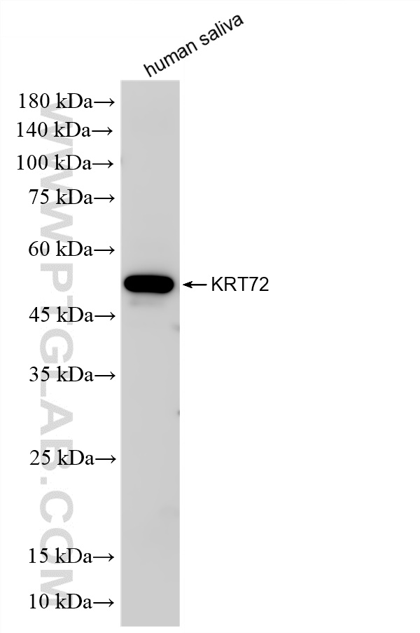 human saliva were subjected to SDS PAGE followed by western blot with 86311-2-RR (KRT72 antibody) at dilution of 1:3000 incubated at room temperature for 1.5 hours. WB analysis of human saliva using 86311-2-RR