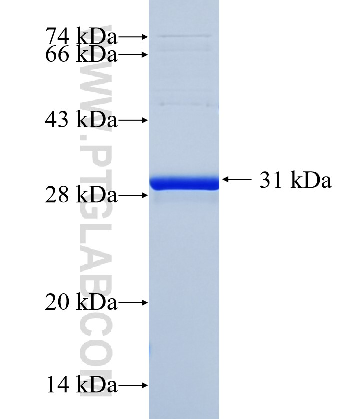 KRT72 fusion protein Ag35944 SDS-PAGE