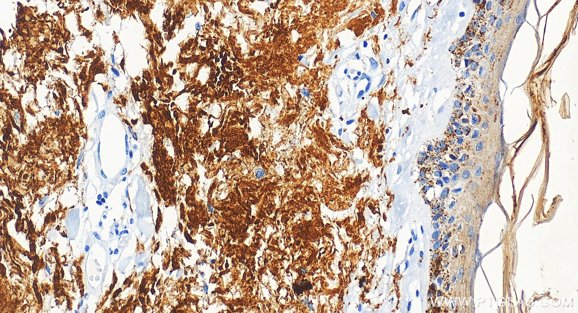 IHC staining of human skin using 86328-1-RR