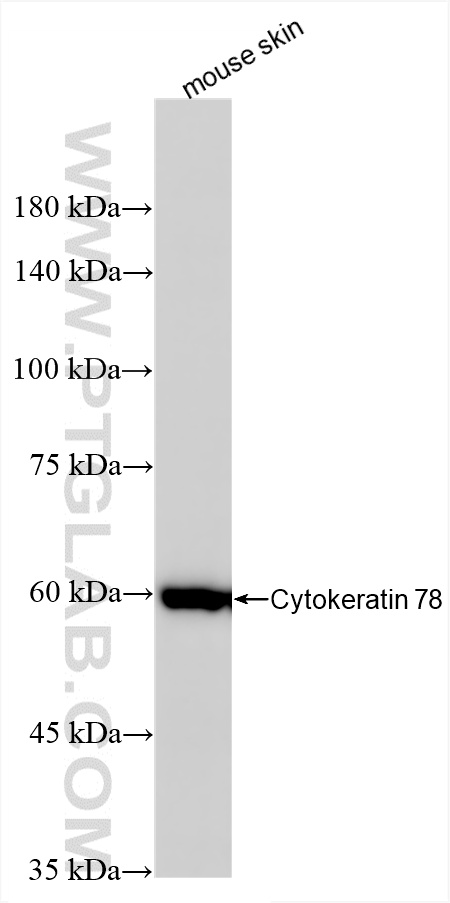 WB analysis of mouse skin using 86328-1-RR