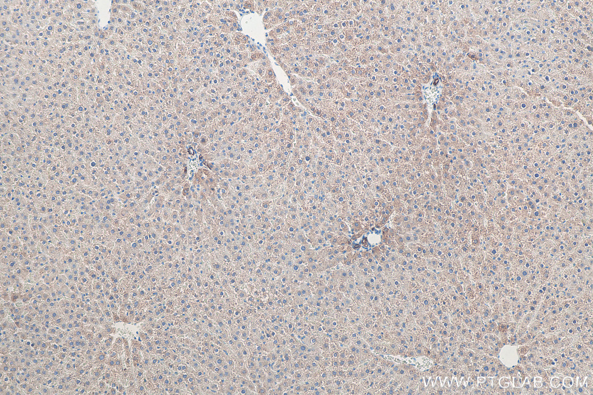 IHC staining of rat liver using 10384-1-AP IHC staining of rat liver using 10384-1-AP