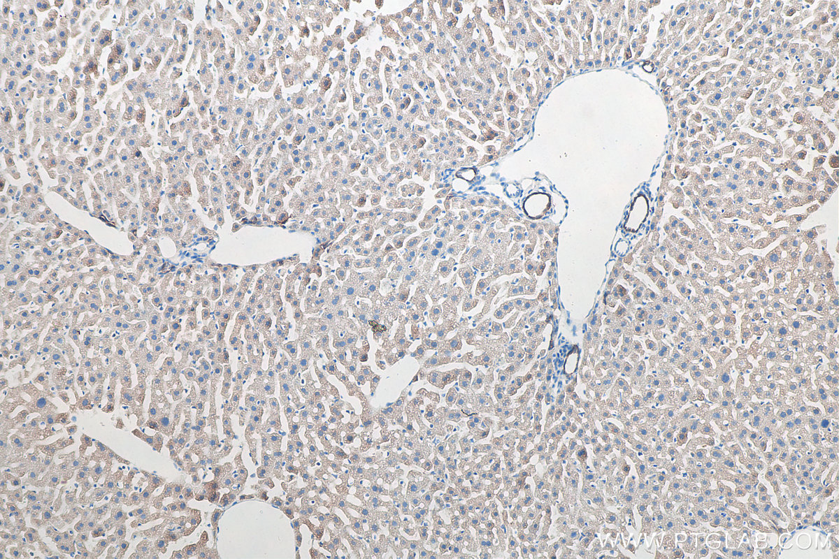 IHC staining of mouse liver using 10384-1-AP IHC staining of mouse liver using 10384-1-AP