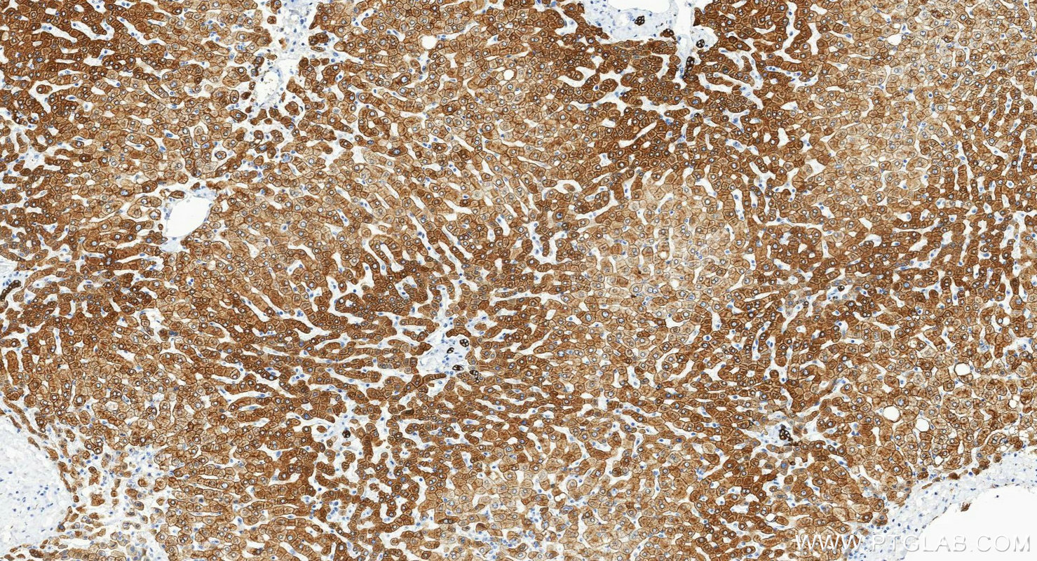 IHC staining of human liver using 10384-1-AP