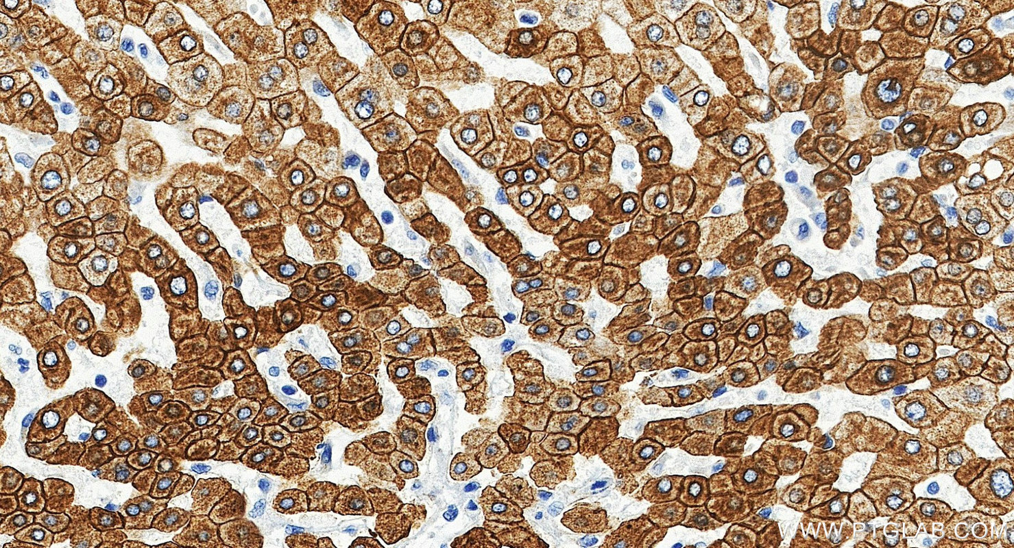 IHC staining of human liver using 10384-1-AP