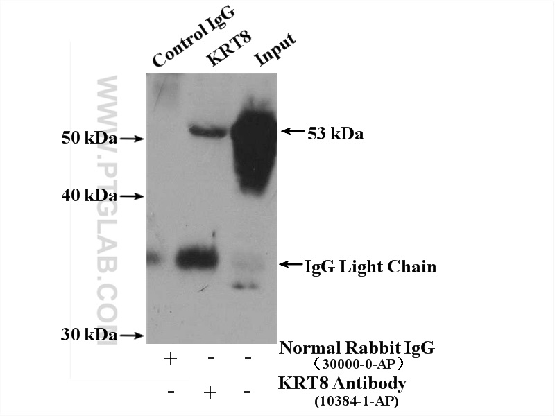 IP experiment of HeLa using 10384-1-AP