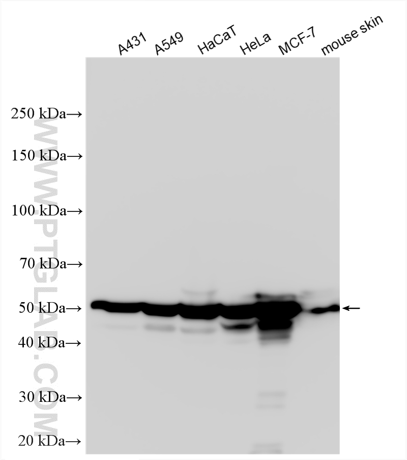 WB analysis using 10384-1-AP