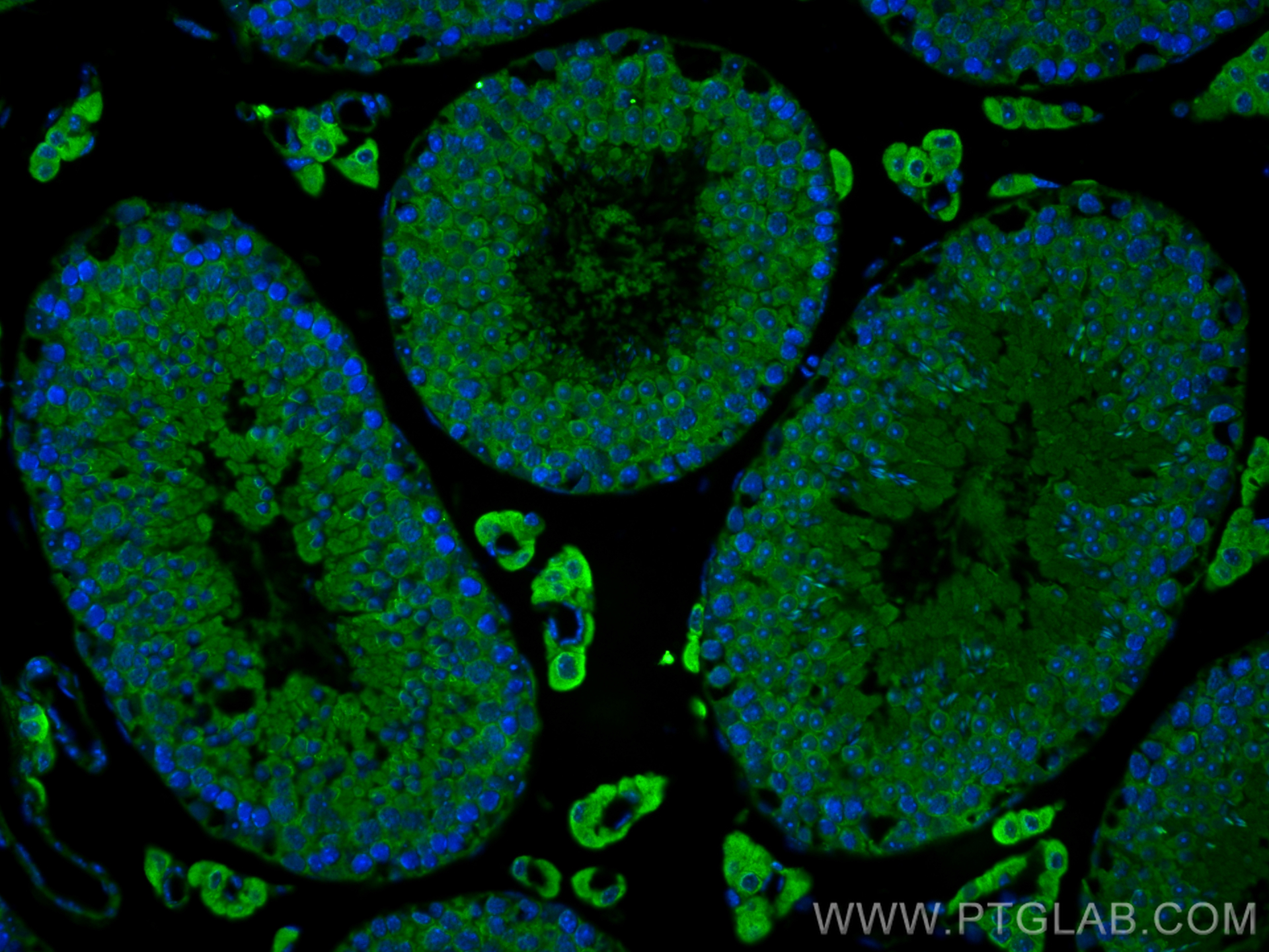 IF Staining of mouse testis using 17514-1-AP