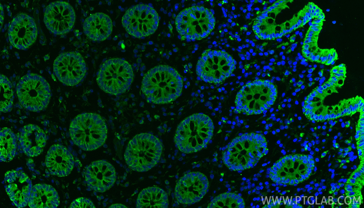 IF Staining of human colon using 17514-1-AP