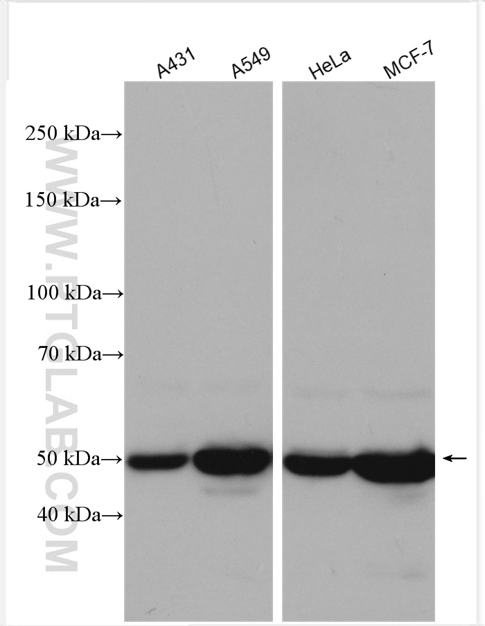 WB analysis using 17514-1-AP