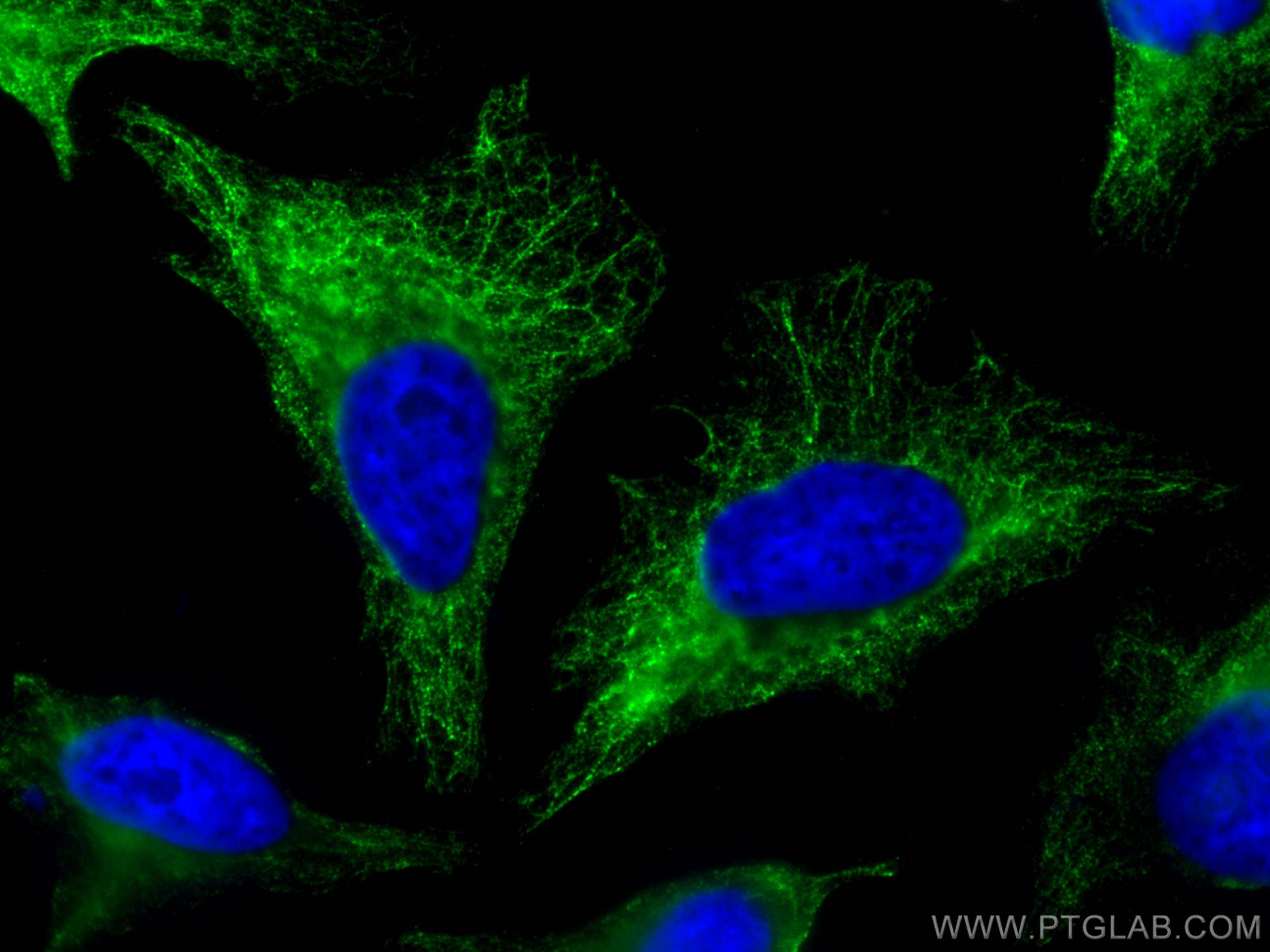 IF Staining of HeLa using 11342-1-AP