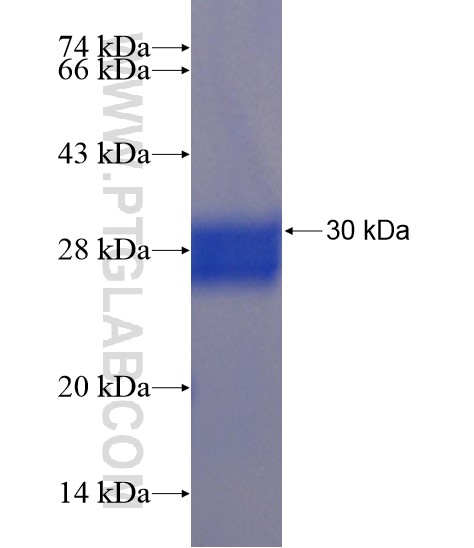 KRT82 fusion protein Ag20179 SDS-PAGE KRT82 fusion protein Ag20179 SDS-PAGE