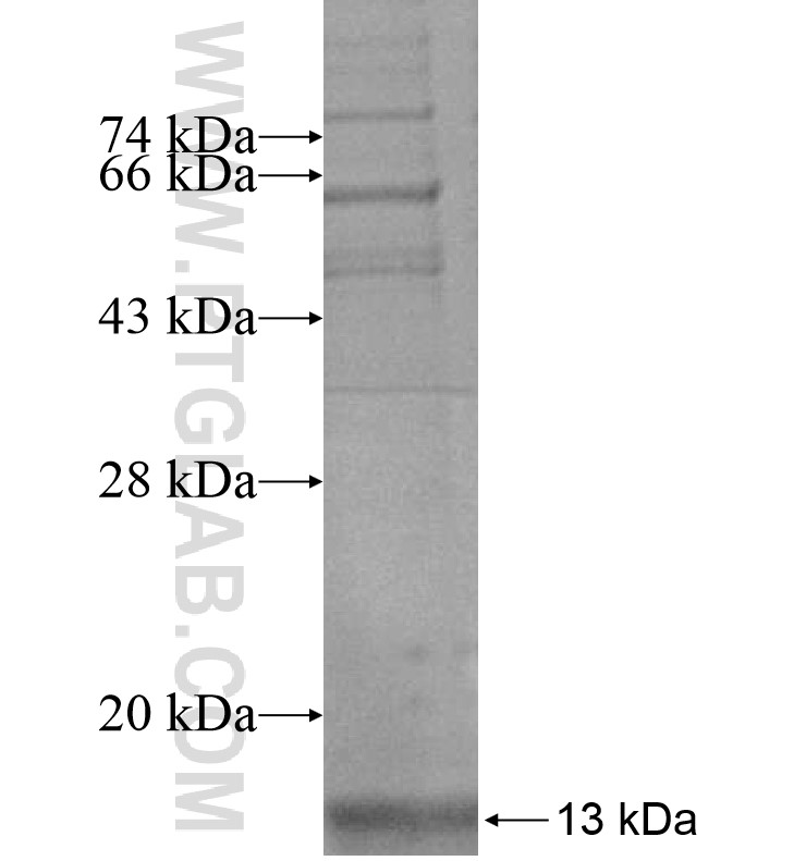 KRTAP3-1 fusion protein Ag16490 SDS-PAGE KRTAP3-1 fusion protein Ag16490 SDS-PAGE