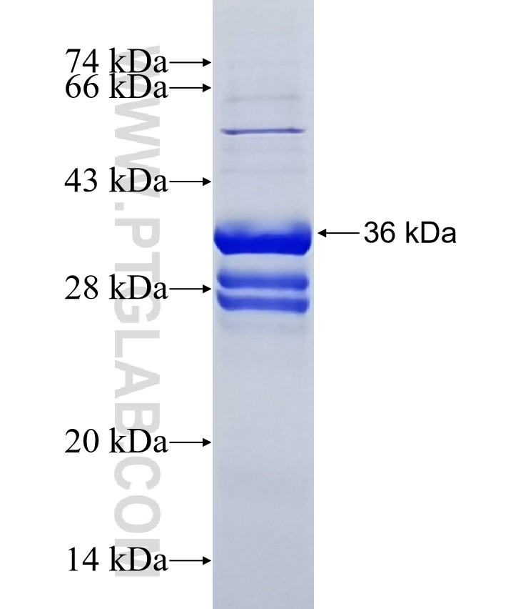 KRTAP3-2 fusion protein Ag11494 SDS-PAGE