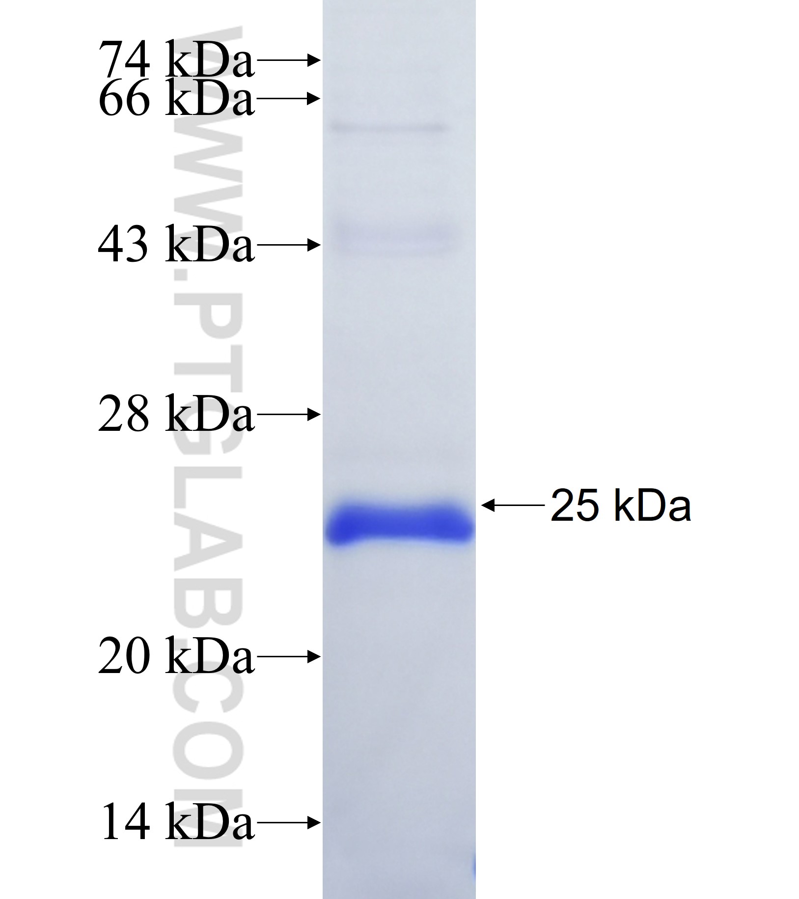 KSR2 fusion protein Ag37155 SDS-PAGE KSR2 fusion protein Ag37155 SDS-PAGE