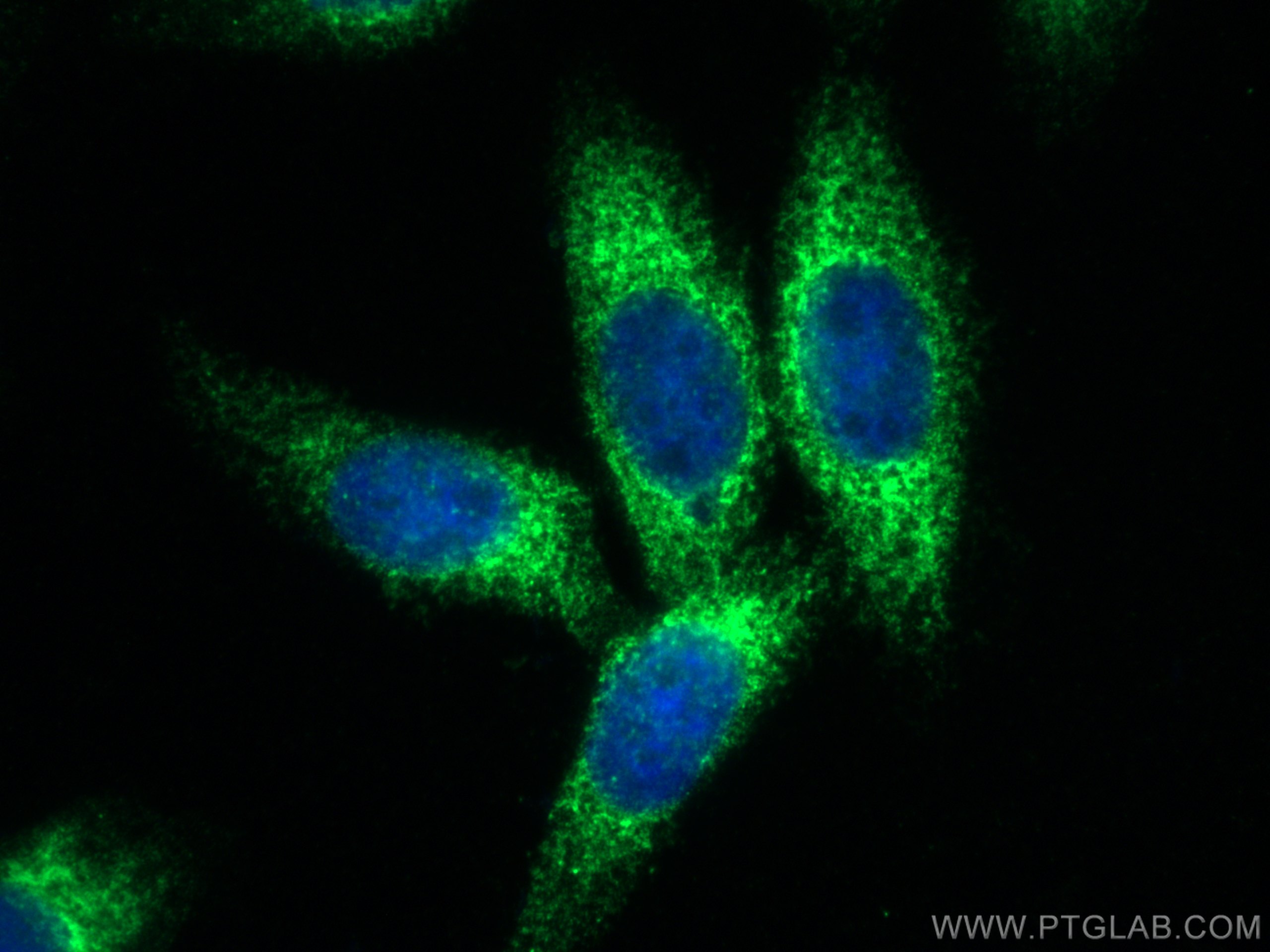 IF Staining of HepG2 using 19841-1-AP