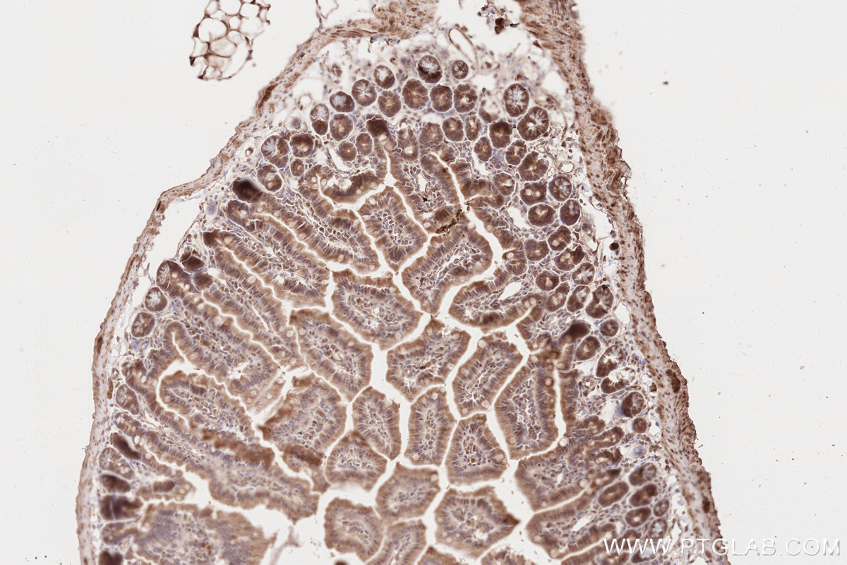 IHC staining of mouse small intestine using 19841-1-AP