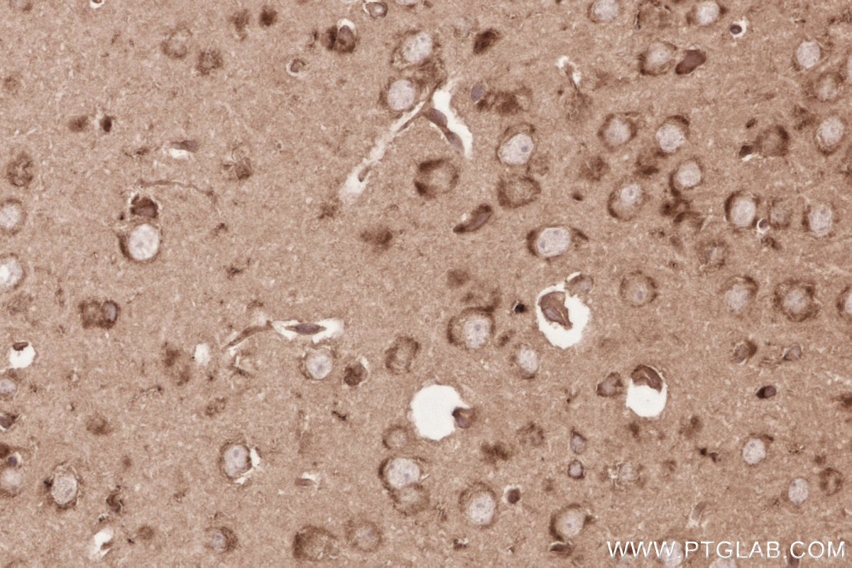 IHC staining of mouse brain using 19841-1-AP