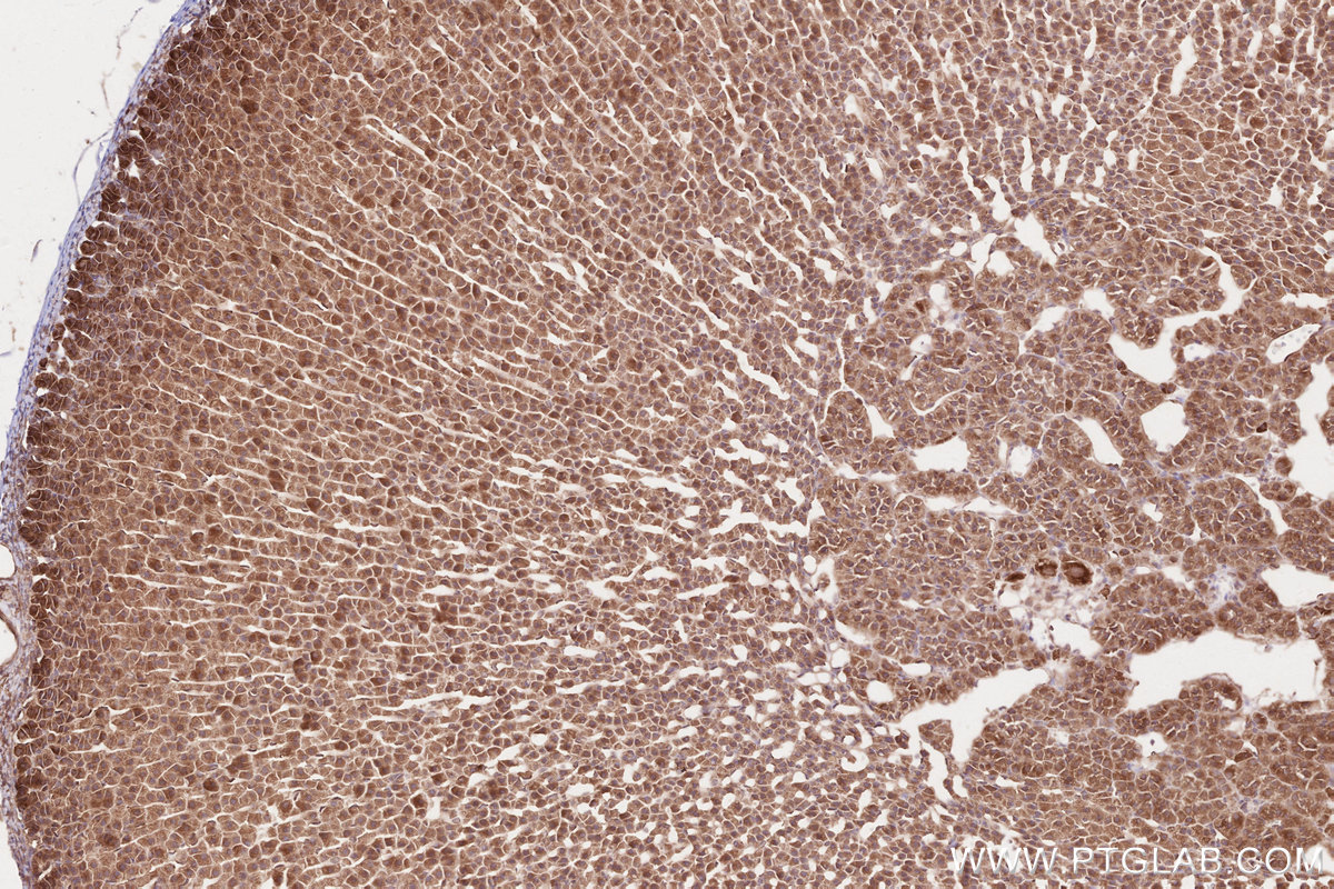 IHC staining of rat adrenal gland using 19841-1-AP