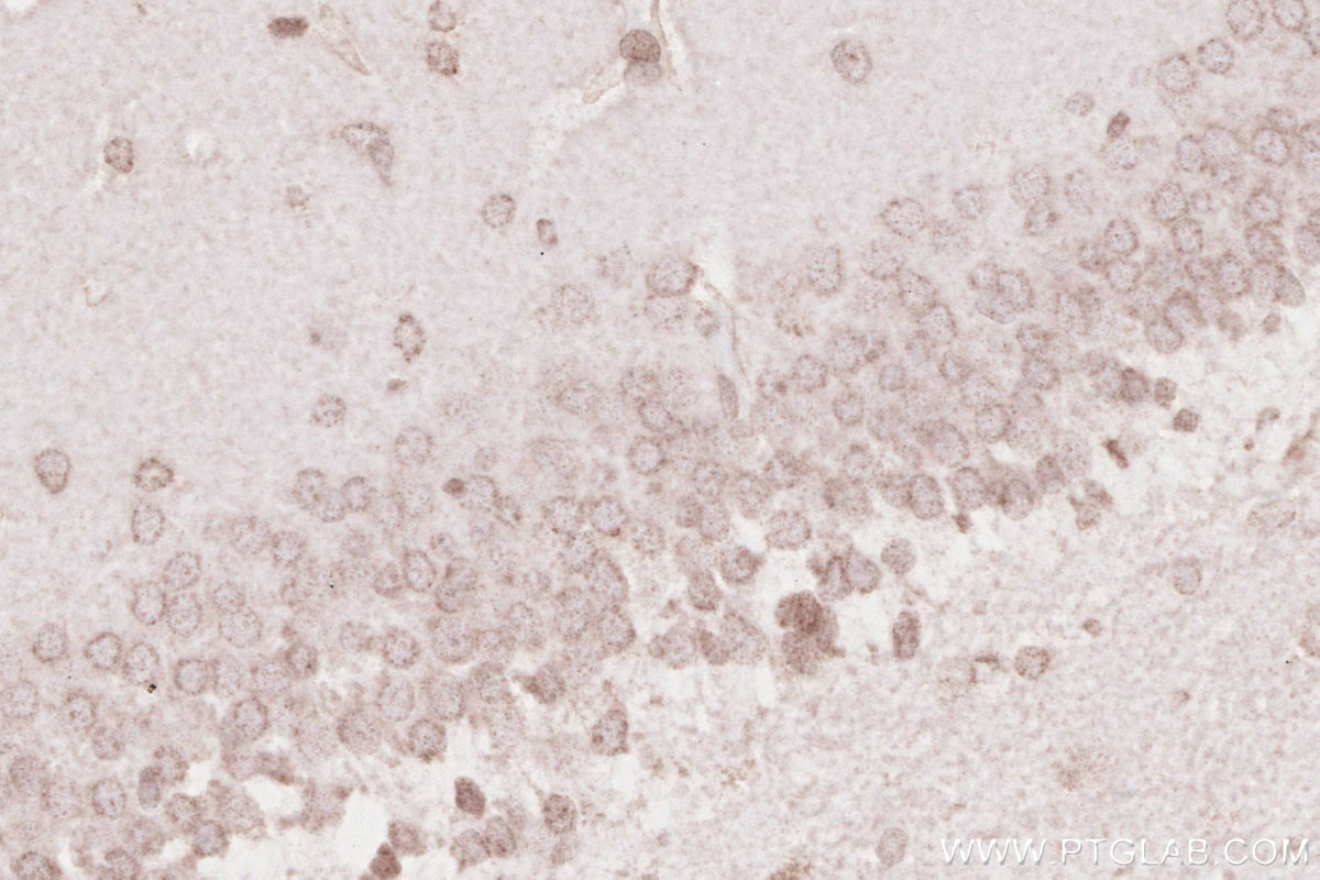 IHC staining of rat brain using 19841-1-AP