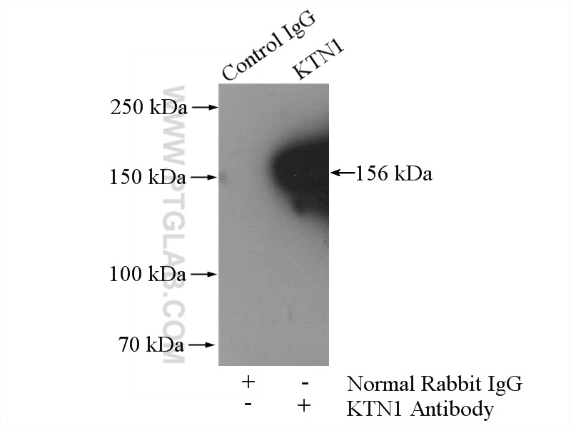 IP experiment of Jurkat using 19841-1-AP