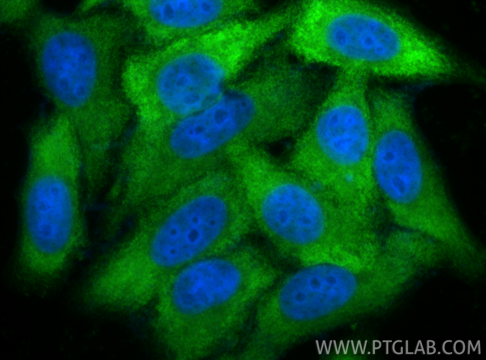 IF Staining of HepG2 using 11796-1-AP