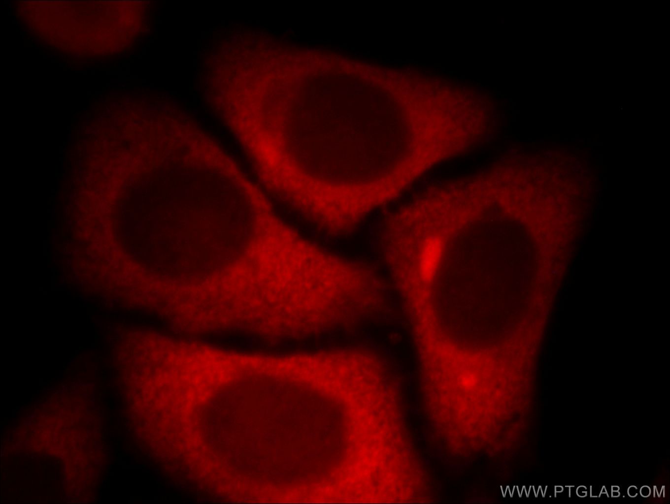 IF Staining of HepG2 using 11796-1-AP