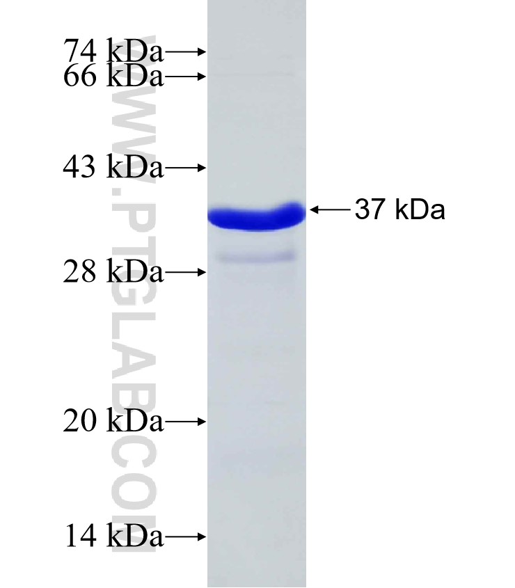 Kdm2b fusion protein Ag30369 SDS-PAGE Kdm2b fusion protein Ag30369 SDS-PAGE