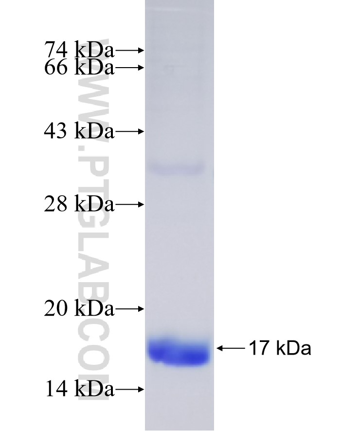 Kdm2b fusion protein Ag33378 SDS-PAGE Kdm2b fusion protein Ag33378 SDS-PAGE