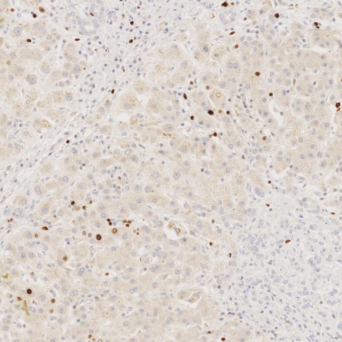 IHC staining of human liver using 66555-6-Ig