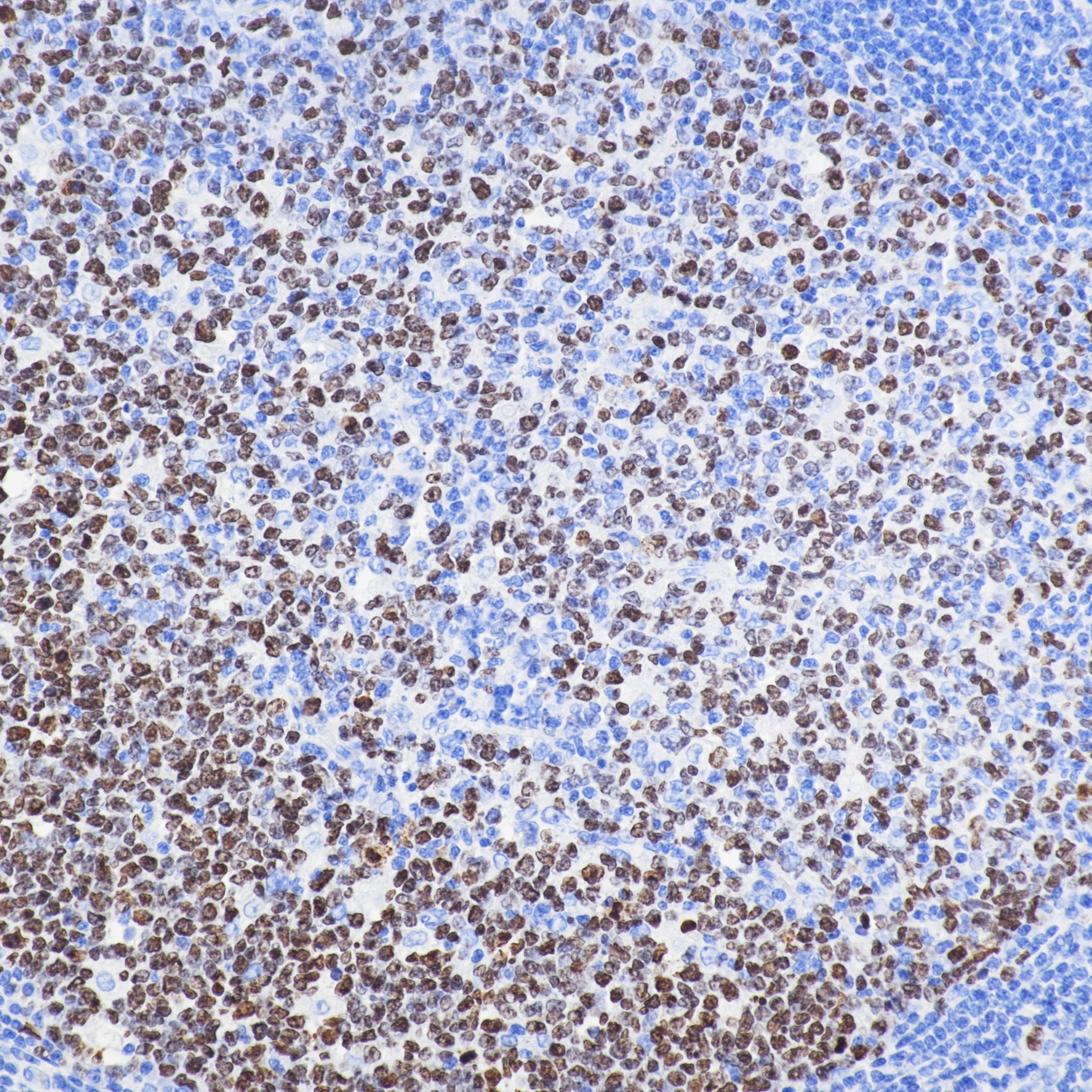 IHC staining of human tonsil using 84192-4-RR