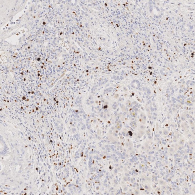 IHC staining of human liver using 84192-4-RR