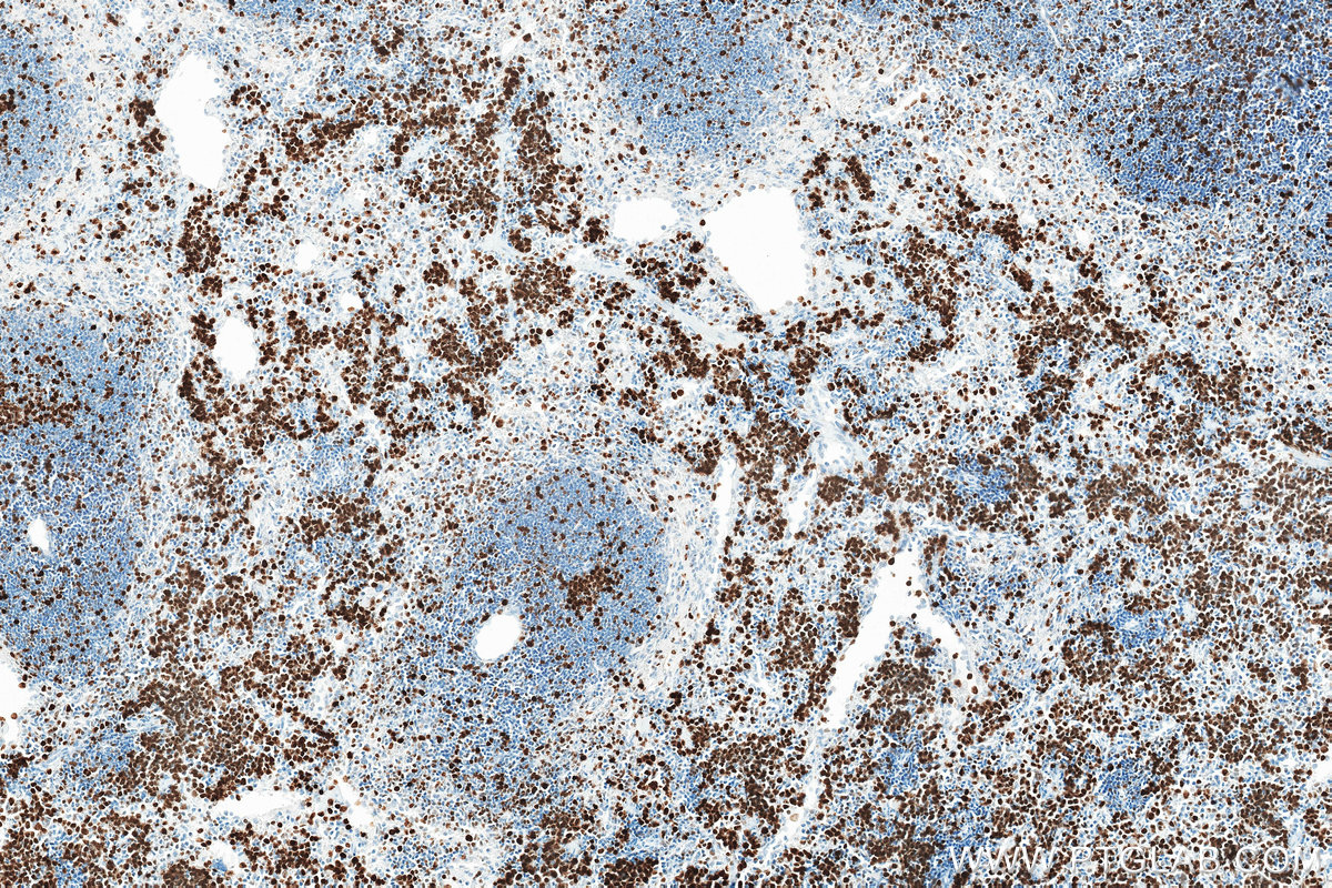 IHC staining of mouse spleen using 84432-1-RR (same clone as 84432-1-PBS)