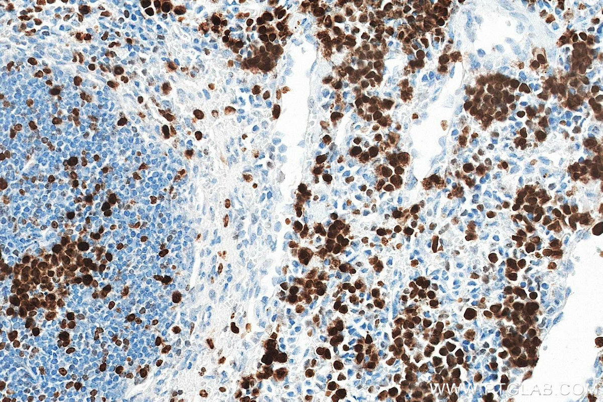 IHC staining of mouse spleen using 84432-1-RR (same clone as 84432-1-PBS)