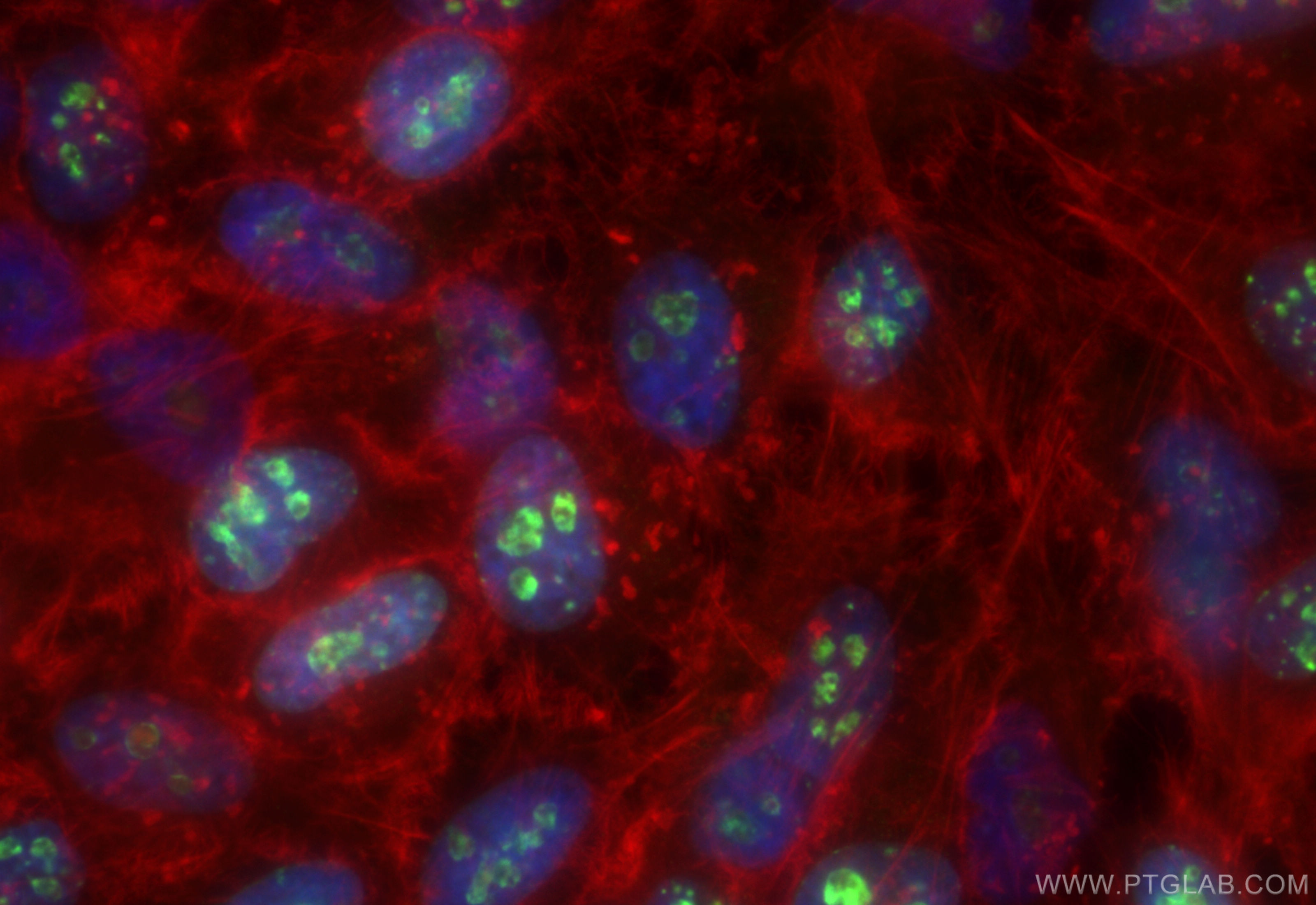 IF Staining of HeLa using CL488-84192-4