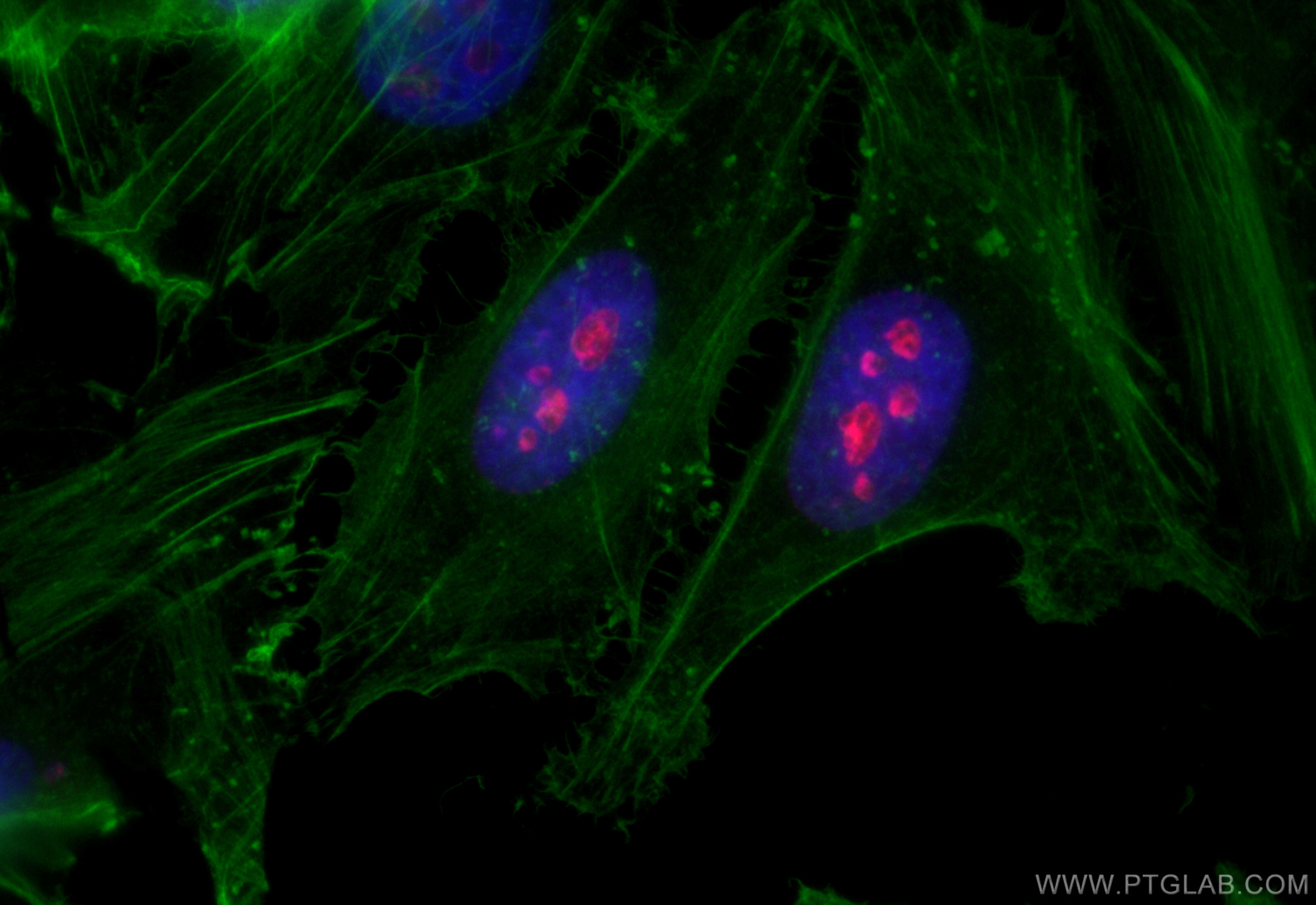 IF Staining of HeLa using CL594-84192-4