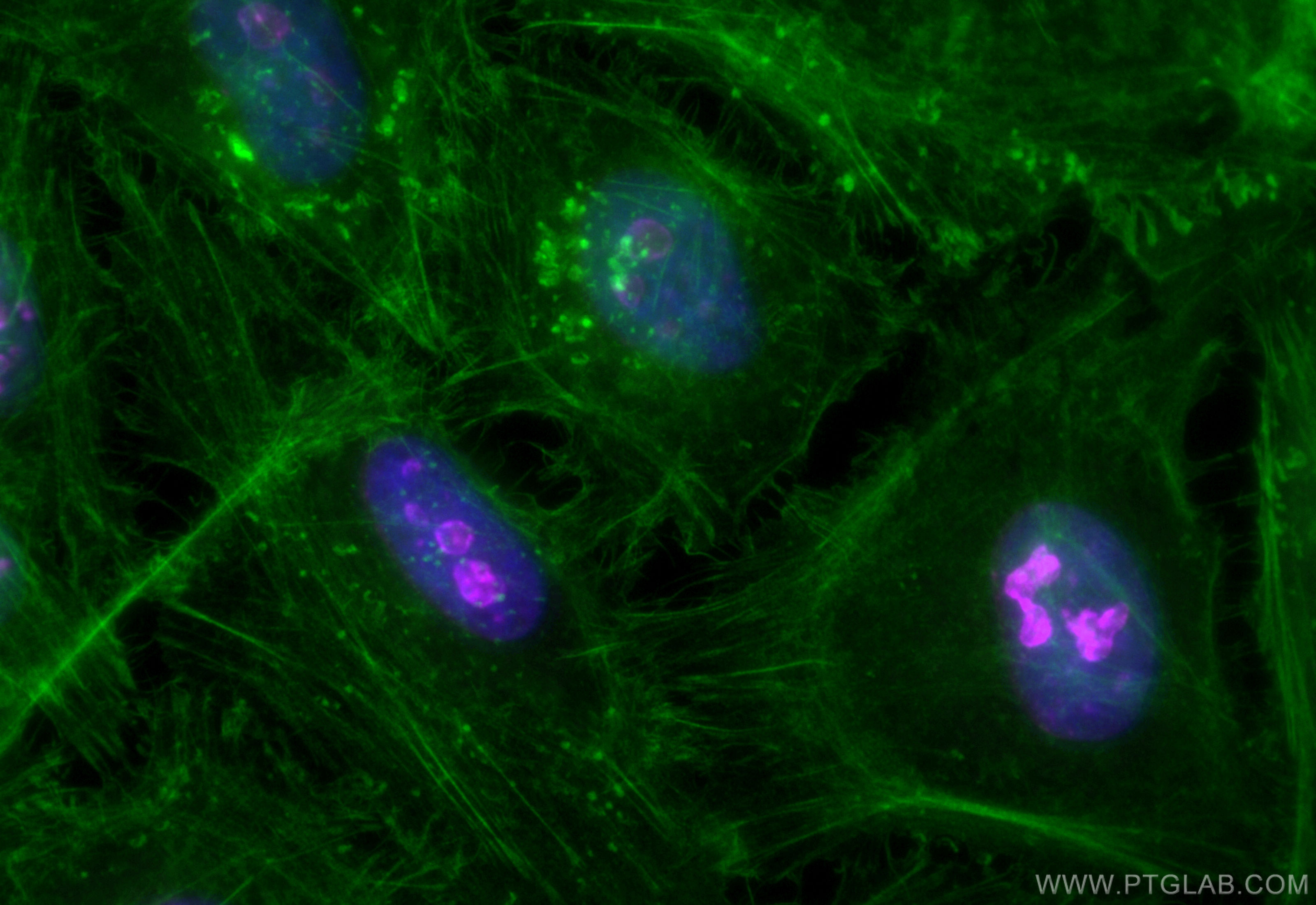 IF Staining of HeLa using CL647-84192-4