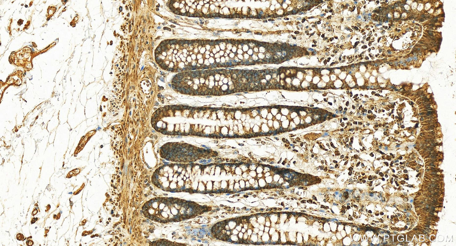 IHC staining of human colon using 29911-1-AP