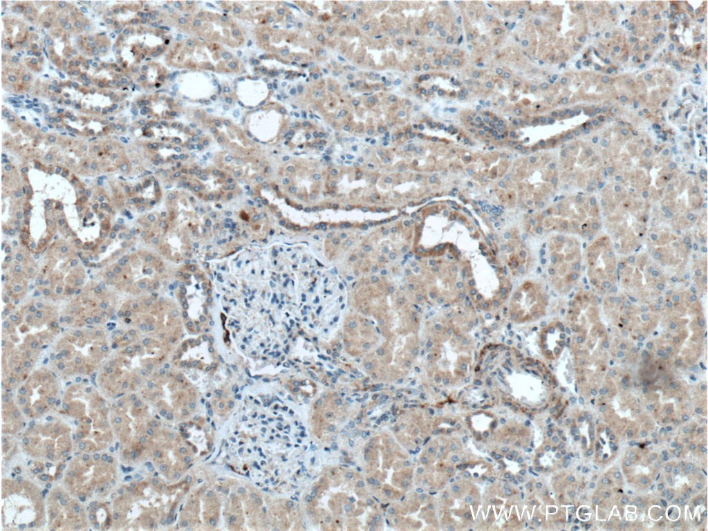 IHC staining of human kidney using 27477-1-AP