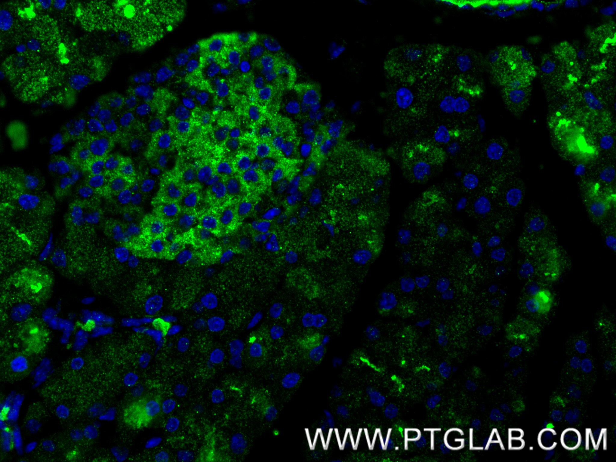 IF Staining of mouse pancreas using 86143-1-RR
