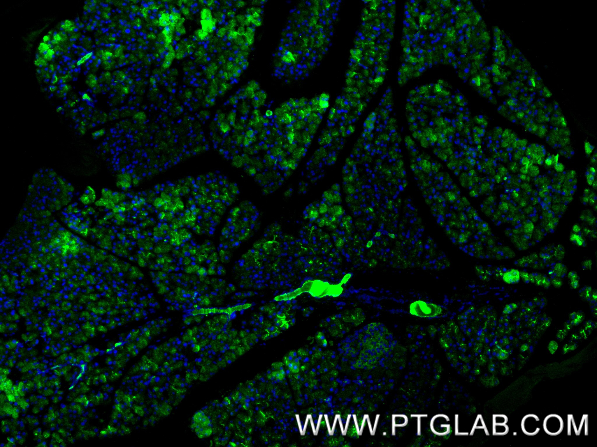 IF Staining of mouse pancreas using 86143-1-RR