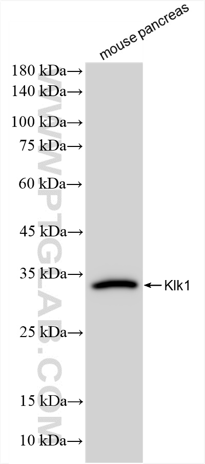 WB analysis of mouse pancreas using 86143-1-RR