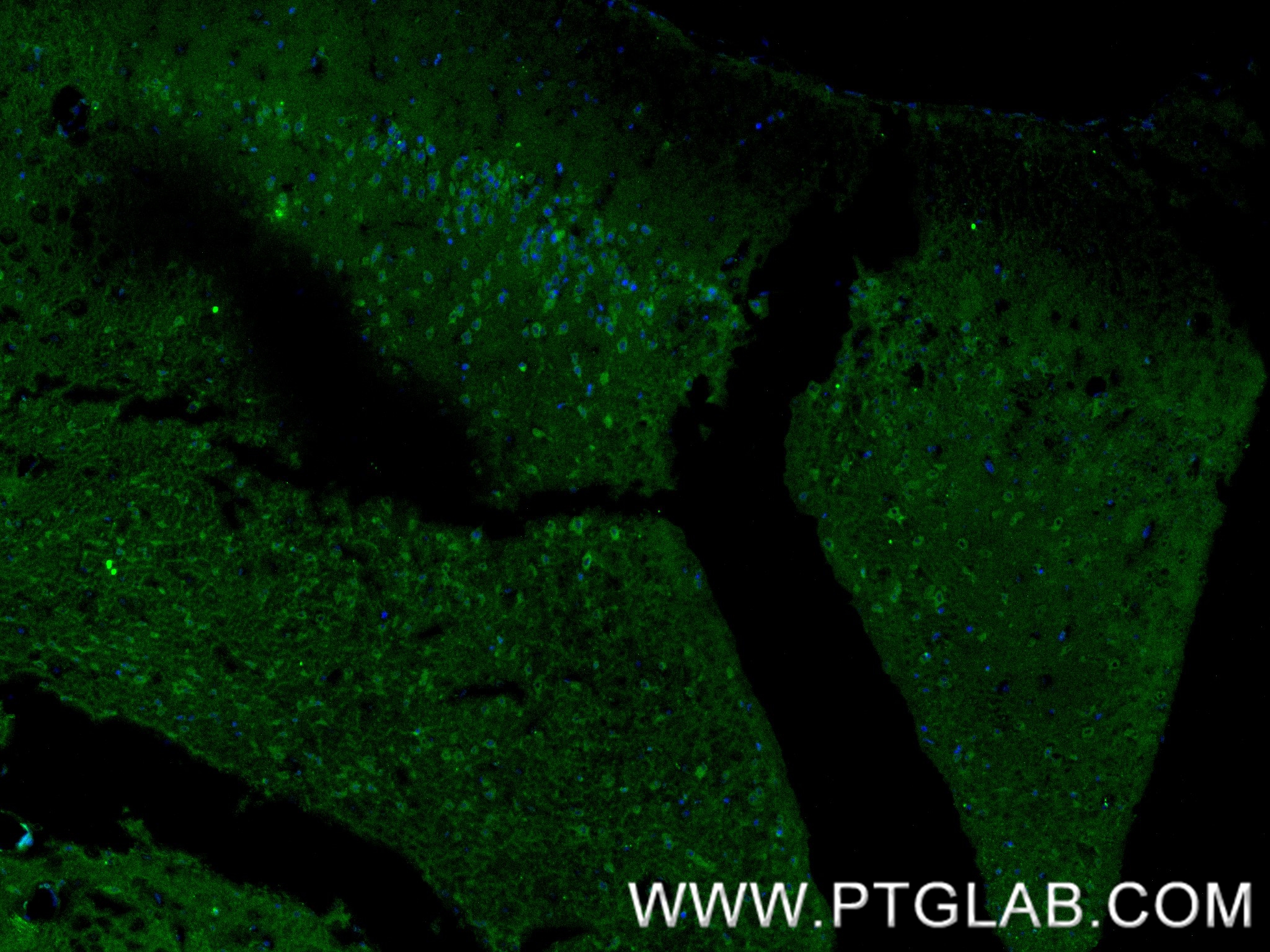 IF Staining of mouse brain using 85133-3-RR