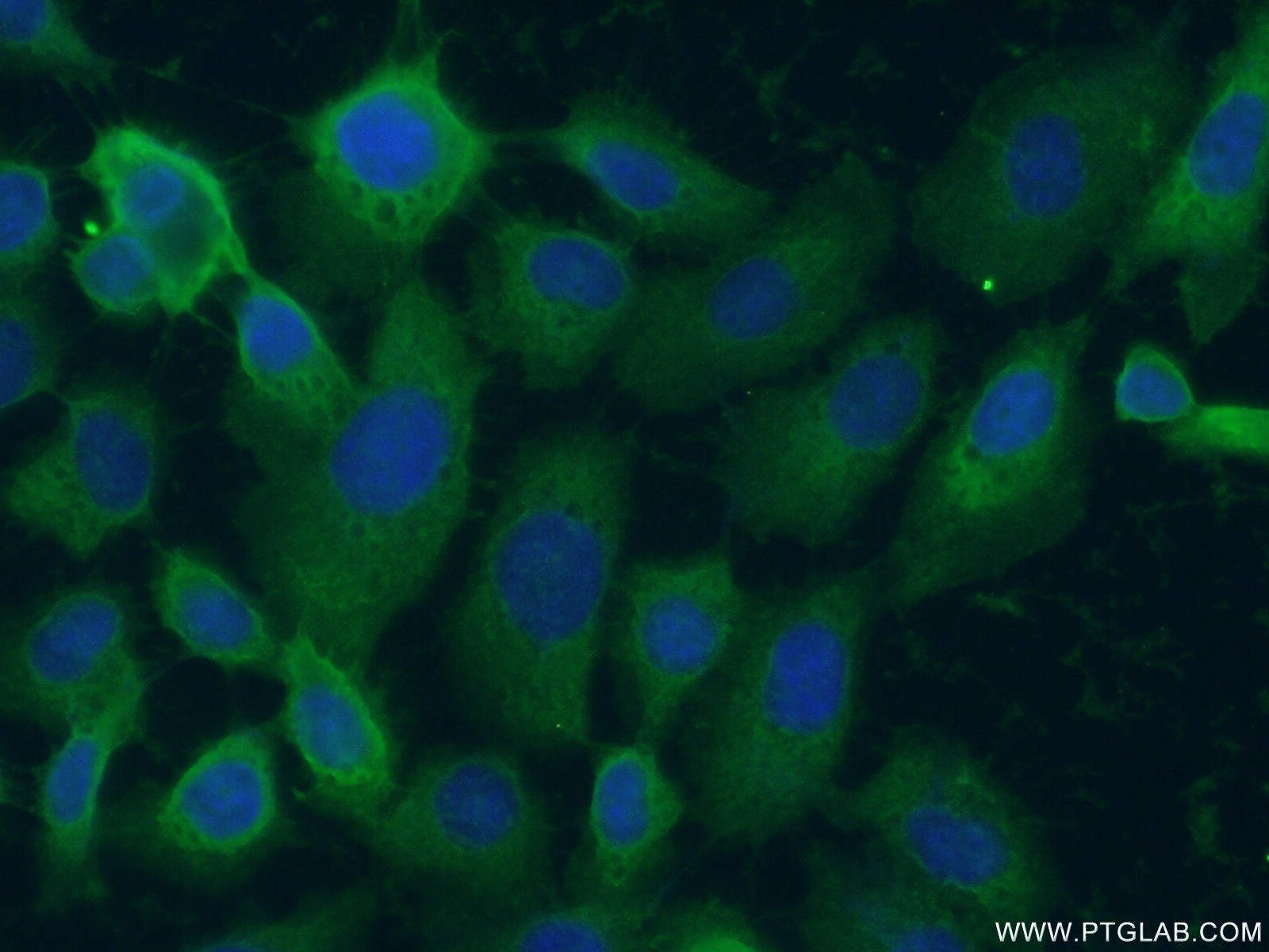 L-Plastin Polyclonal antibody