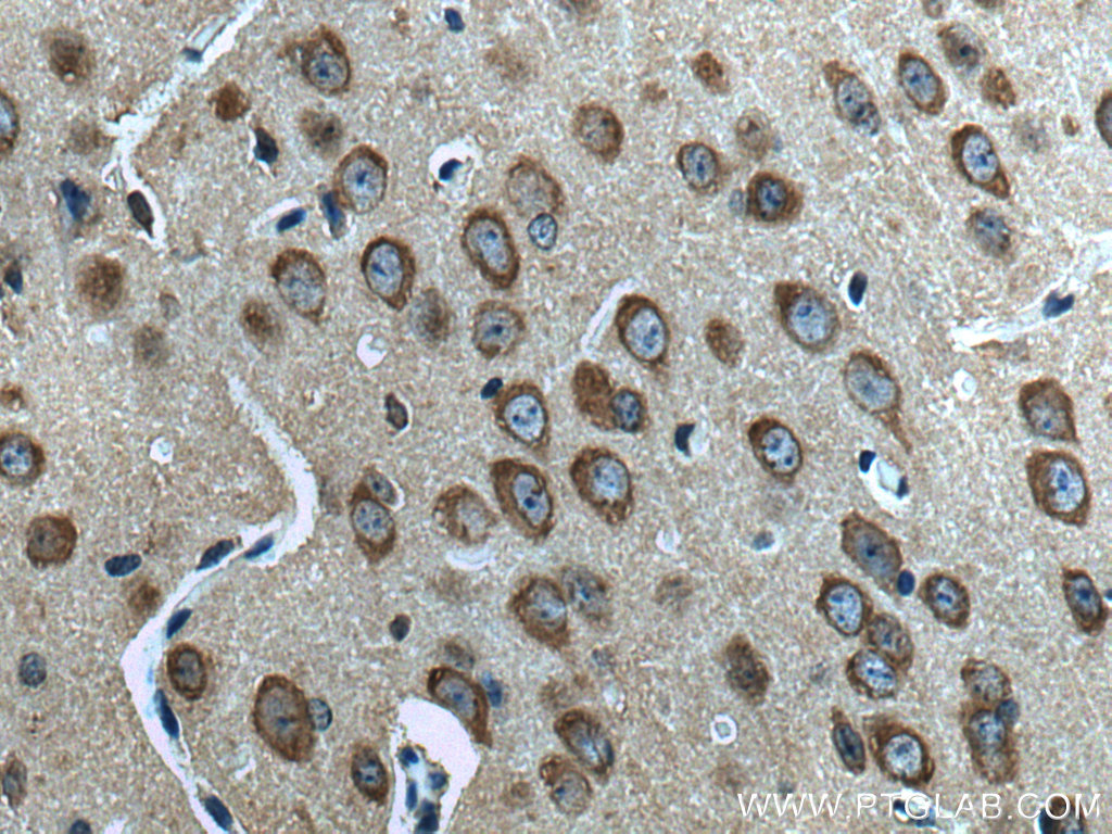 IHC staining of mouse brain using 21774-1-AP