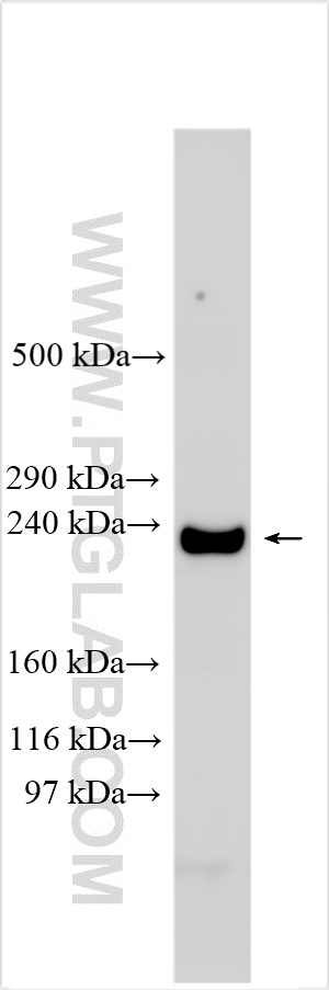 WB analysis using 21774-1-AP
