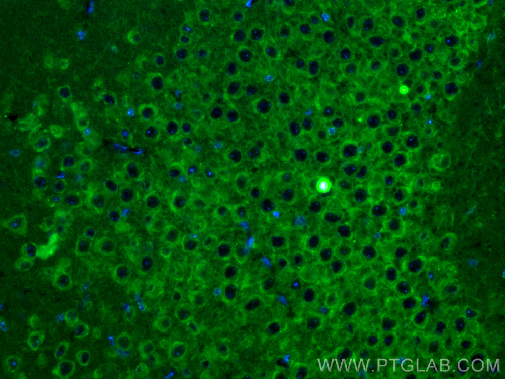 IF Staining of mouse brain using CL488-21774
