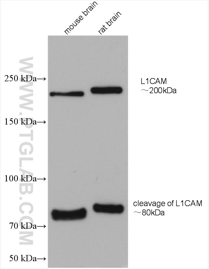 L1CAM