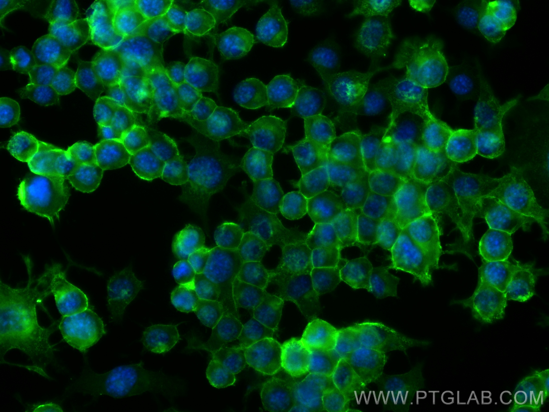 IF Staining of Neuro-2a using 32885-1-AP