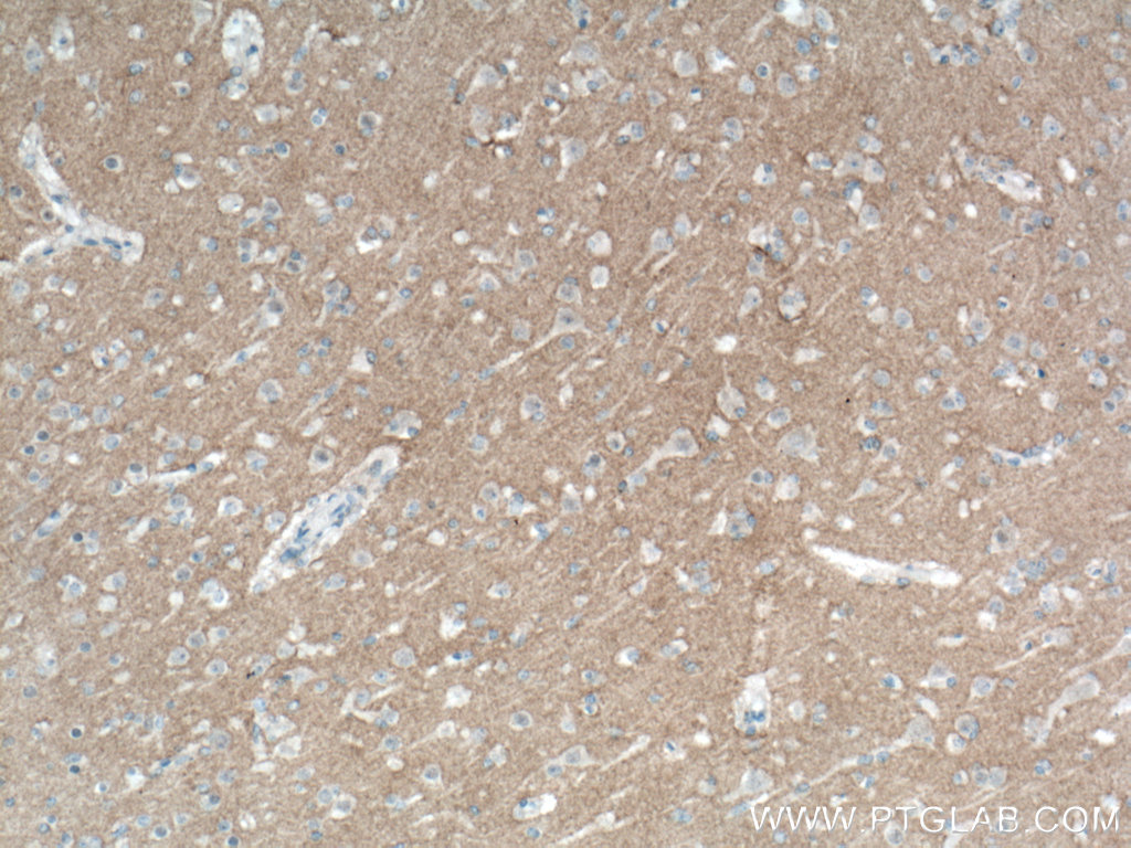 IHC staining of human brain using 67115-1-Ig